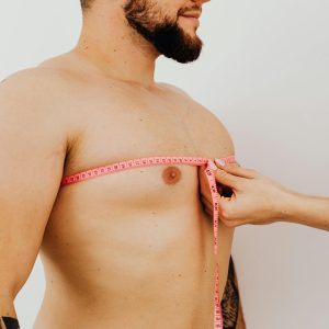 ginecomastia, cirurgia ginecomastia, mama masculina, ginecomastia masculina